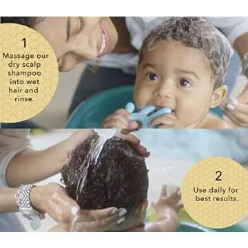 Bella B Cradle Cap Shampoo & Treatment for Babies