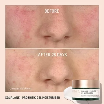 Biossance Probiotic Gel Moisturizer for Sensitive Skin