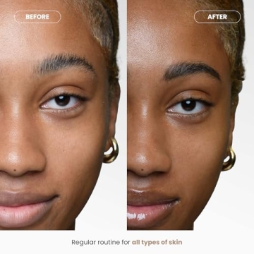 CO2Lift Skin Treatment for Puffiness, Dark Circles & Radiance