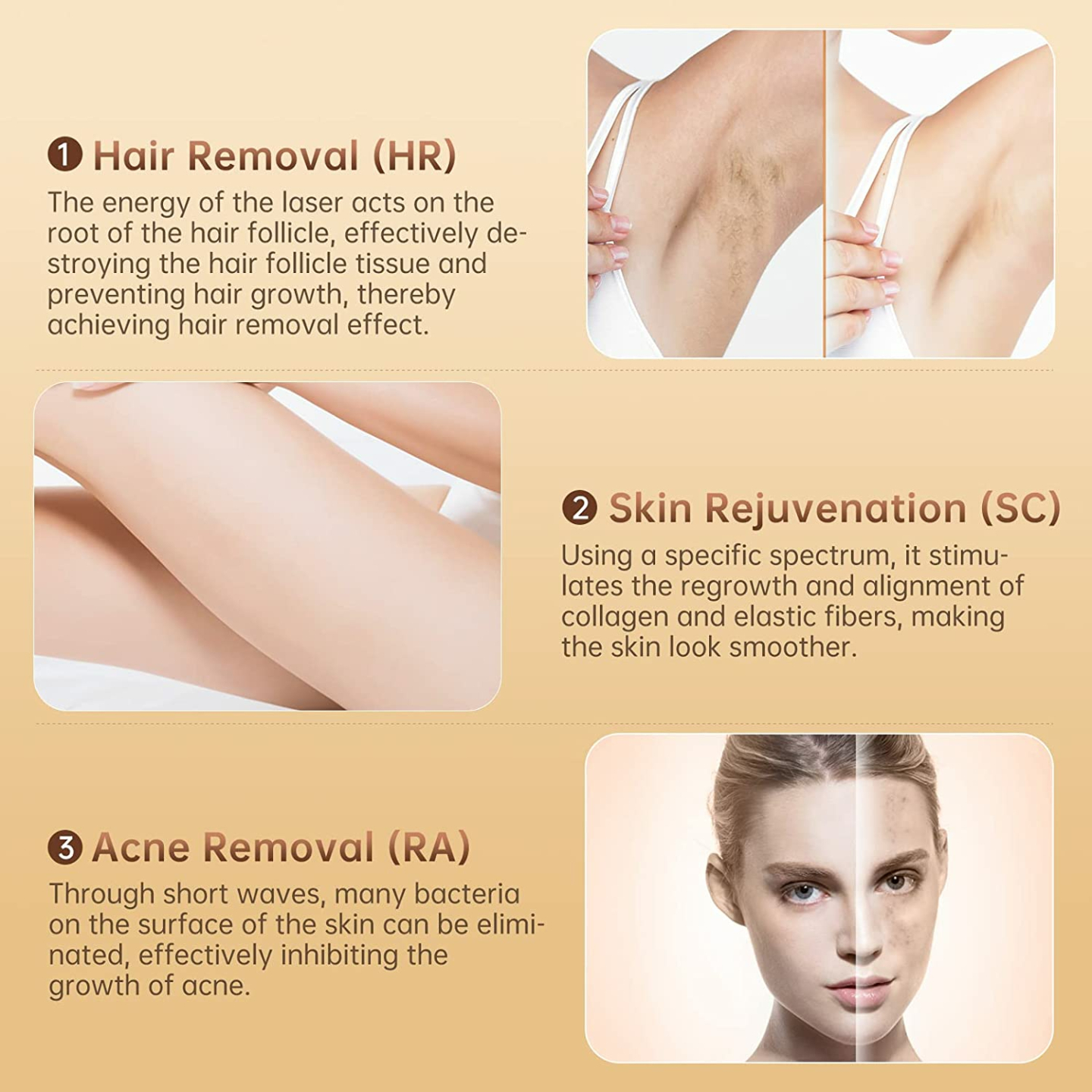 IPL Laser Hair Removal Device - 3-in-1 for All