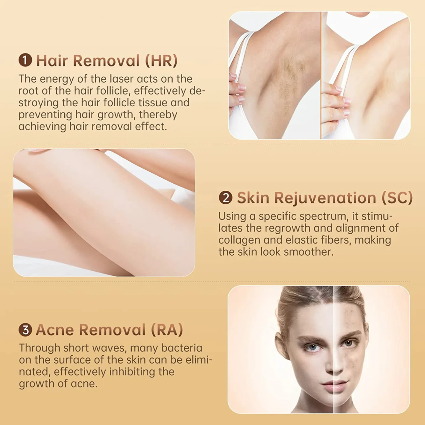 IPL Laser Hair Removal Device - 3-in-1 for All