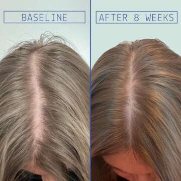 AAVRANI Hair Density Boosting Treatment - Ashwagandha, Vegan Collagen, And Turmeric Scalp Serum For ...