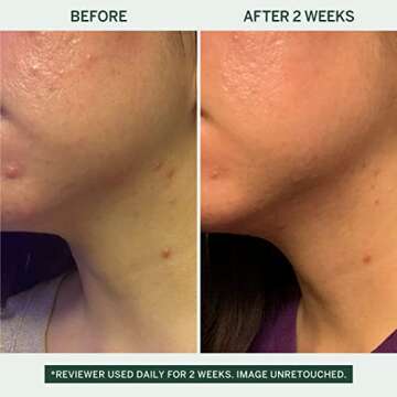 Urban Calm Barrier Cream with Hyaluronic Acid - Hydrating Lotion