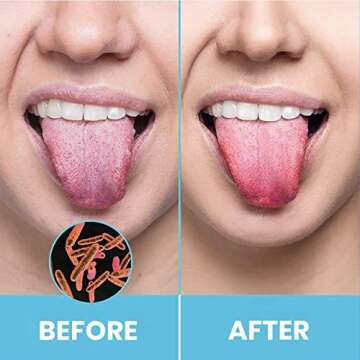 Tongue Scraper for Adults by HOKIN (2Pcs Oral Care Pack) Stainless Steel Tongue Cleaners Reduce Bad ...