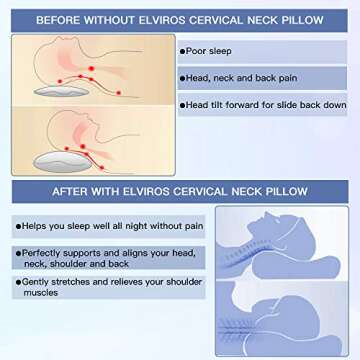 Elviros Cervical Pillow for Neck Pain Relief and Comfort