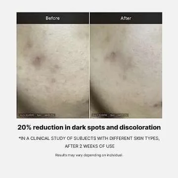 Medicube Deep Vita C Serum 14.5% Vitamin C for Radiant Skin