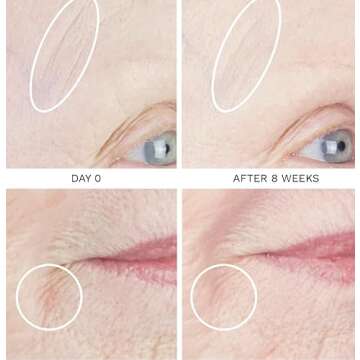 City Beauty UpLift Firming Serum - Face Serum - Lift & Tighten - Natural Sagging Skin Solution with ...