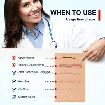 Silicone Scar Sheets(1.8” x 157”Inch- 4M), Scar Tape, Scar Strips, Medical Grade, Scar Remover, C-Section, Surgery, Keloid, Tummy Tuck, Scar Patch.