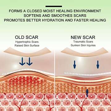 Silicone Scar Sheets(1.8” x 157”Inch- 4M), Scar Tape, Scar Strips, Medical Grade, Scar Remover, C-Section, Surgery, Keloid, Tummy Tuck, Scar Patch.