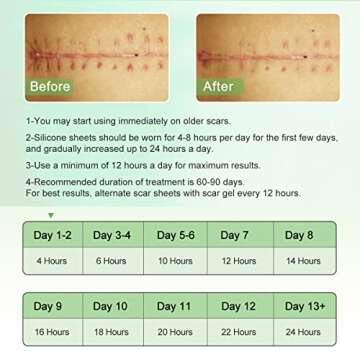 Silicone Scar Sheets(1.8” x 157”Inch- 4M), Scar Tape, Scar Strips, Medical Grade, Scar Remover, C-Section, Surgery, Keloid, Tummy Tuck, Scar Patch.