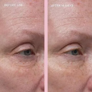 Alpyn Wild Nettle & Niacinamide Firming Serum | Visibly Smooth, Plump, & Moisturize | Reduce the Look of Fine Lines & Pores - For All Skin Types | 1 oz / 30 ml