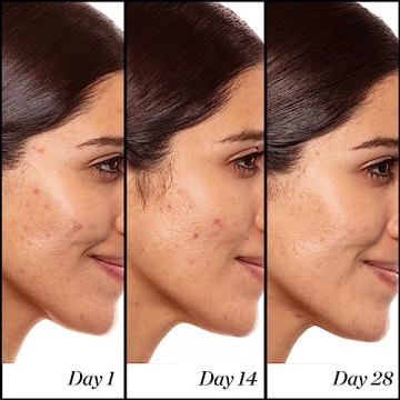 Sunday Riley A+ Retinoid Serum - Advanced Anti-Aging Solution