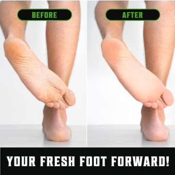 Viking Revolution Tea Tree Body Wash Soap for Men - Helps Athlete's Foot, Jock Itch, Eczema & Body Odors - Extra Strength Tea Tree Oil Men's Body and Foot Wash