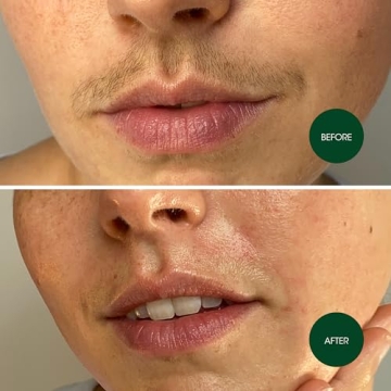 Nad's Facial Wax Strips – Easy Facial Hair Removal at Home