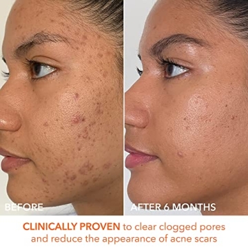 Dr. Dennis Gross Alpha Beta Peel for Radiant Skin