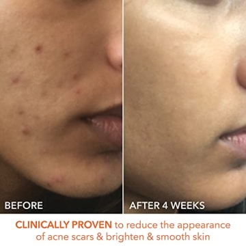 Dr. Dennis Gross Alpha Beta Peel for Radiant Skin