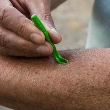 TickCheck Tick Remover Kit for Pets and Humans 3 Pack