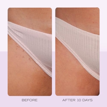 Ingrown Hair Prevention Pads - Aftershave Treatment - 28 Pads