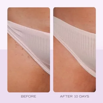 Ingrown Hair Prevention Pads - Aftershave Treatment - 28 Pads