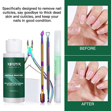 XIFEPFR Cuticle Remover Kit - Cuticle Remover Cream & Cuticle Oil Pen for Soften Moisturize, Cuticle Trimmer/Nipper, Cuticle Pusher and Nail Cotton Pads for Professional Manicure, Gifts for Women