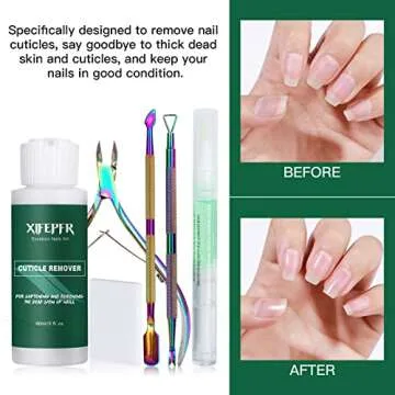XIFEPFR Cuticle Remover Kit - Cuticle Remover Cream & Cuticle Oil Pen for Soften Moisturize, Cuticle Trimmer/Nipper, Cuticle Pusher and Nail Cotton Pads for Professional Manicure, Gifts for Women