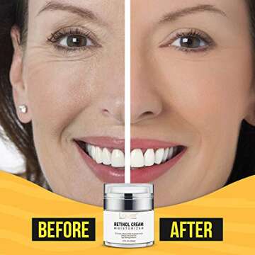 Retinol Moisturiser for Face and Eye area Anti Ageing Cream with Hyaluronic Acid, 2.5% Active Retinol and Vitamin E Reduces Appearance of Wrinkles and Fine lines Best Day and Night Face Cream