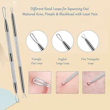 Blackhead Remover Pimple Popper Tool Kit, 6-in-1 Blackhead Comedone Acne Blemish Pimple Extractor Tool Kit Tweezers Kit Skin Care Tools for Face