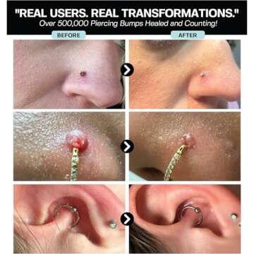 Hypochlorous Acid Spray for Fast Piercing Healing