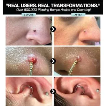 Hypochlorous Acid Spray for Fast Piercing Healing