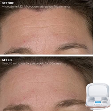 Trophy Skin MicrodermMD At Home Microdermabrasion Kit