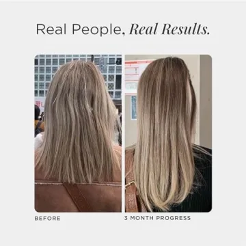 JSHealth Hair Growth Vitamins with Zinc & Iodine