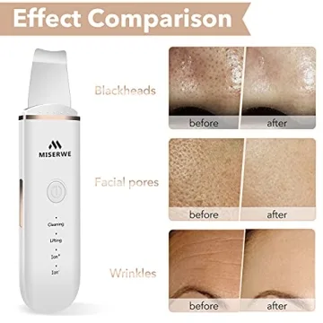 Deep Cleansing Skin Scrubber Spatula for Pores