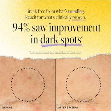 Derma E Vitamin C Renewing Moisturizer – Brightening and Hydrating Facial Skin Renewing Cream – Anti-Aging Facial Moisturizer and Day Cream, 2 oz