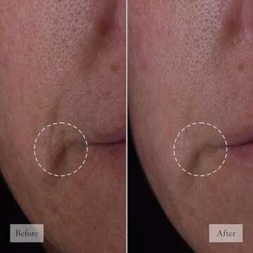 philosophy Bouncy Skin Facial Serum - Rebuild Collagen