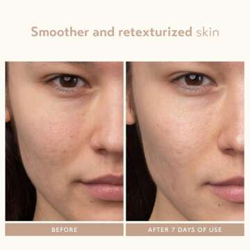 Lactic Acid Face Serum for Radiant Skin by Shani Darden