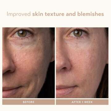 Lactic Acid Face Serum for Radiant Skin by Shani Darden