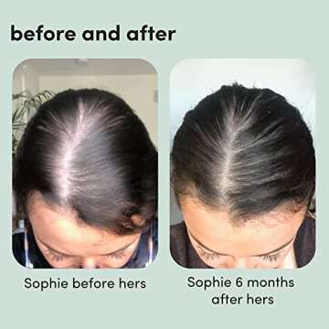 Hers Minoxidil Foam 5% Hair Growth Treatment for Women