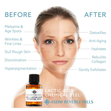 ASDM Beverly Hills 60% Lactic Acid Peel For All Skin Types