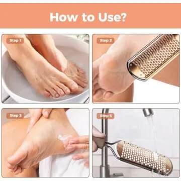 Foot File Foot Scrubber Pedicure - Callus Remover for Feet Easkep Professional Grater Rasp Foot Scraper Corns Callous Removers Cracked Dead Skin Remover for Dry and Wet Feet (Golden)