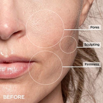 Beauty BIO GloPRO Cryo Roller Duo for Youthful Skin