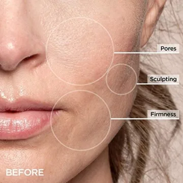 Beauty BIO GloPRO Cryo Roller Duo for Youthful Skin