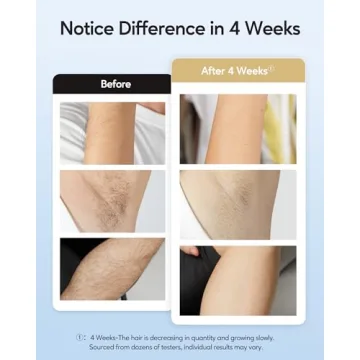 INNZA Laser Hair Removal Ice Cooling IPL Device for Women