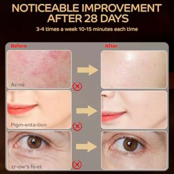 Hottoerak Red Light Therapy for Face, LED Red Light Therapy Mask 660nm & 850nm Wavelength for Home Use