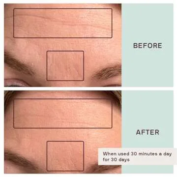 Dermaclara Face Patches Kit - Anti Wrinkle Patches for Forehead, Smile Lines, Silicone Anti-Wrinkle Frown Line Treatment, Up to 30 Uses - 1 Forehead, 2 Mouth, 2 Eye, 1 Neck & 1 Patch Prep Cleanser