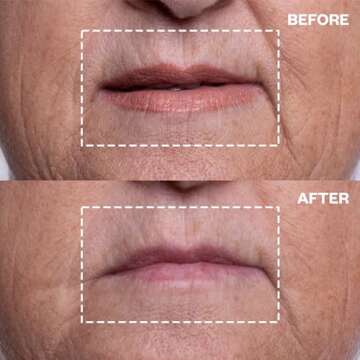 Wrinkles Schminkles Mouth & Lip Wrinkle Patch - Reusable Silicone Smoothing Pads for Noticeable Wrinkle Reduction - Lip Wrinkle Prevention for Youthful, Smooth Skin (2 Pack)