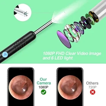 Earwax Removal Camera with 1080P HD for Home Care
