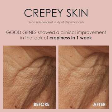 Sunday Riley Good Genes All-in-One Lactic Acid Treatment Face Serum