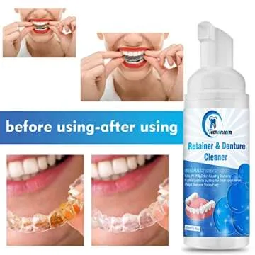 Aligner and Denture Cleaner Foam - Fast-Acting Oral Care