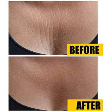 Hoosh Silicone Chest Wrinkle Pads 3 pack, Reusable Overnight Anti Aging Chest Pads for Wrinkle Smoothing, Decollete Anti Wrinkle Patches, Chest Wrinkle Pads Sleeping Reusable