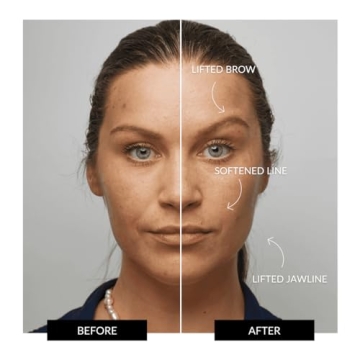 ZIIP Halo Facial Device for Youthful Glowing Skin at Home